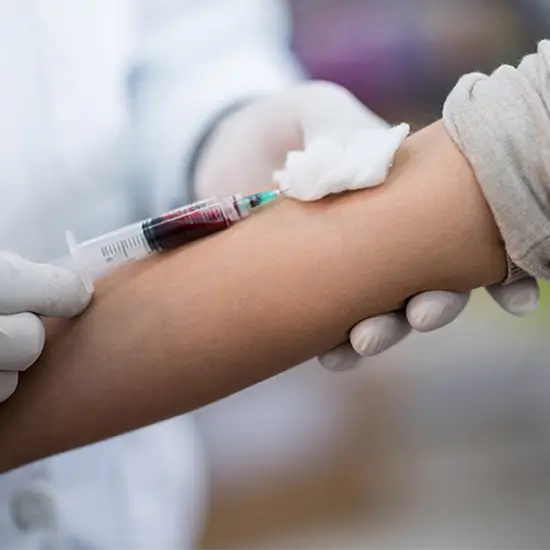 thyroxine binding globulin (TBG)